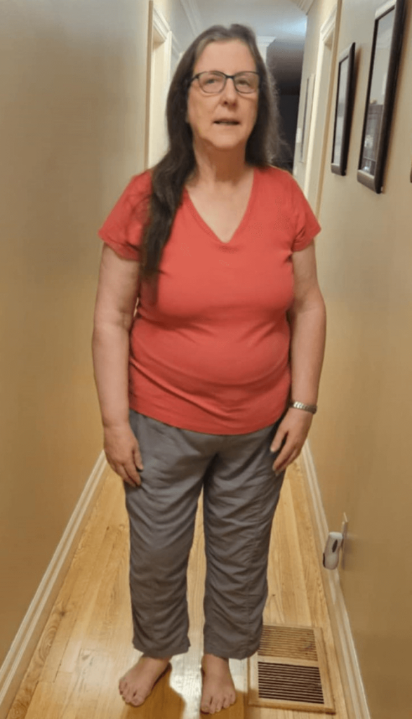 Cindy Jane After June 2025 (1) after-21-dYS-PICTURE-CINDY-JANE