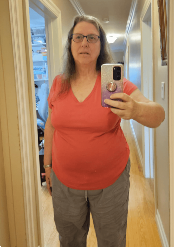 Cindy Jane June 2025 Before 1 (1) CJ-before-picture