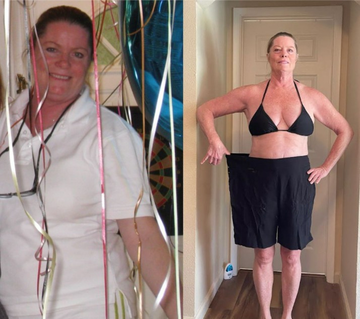Jeanne's pictures of before and after weight loss